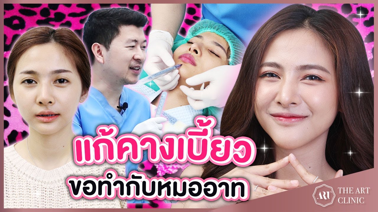 VLOG : น้องศิ แก้คางเบี้ยว ขอทำกับหมออาทเท่านั้น!