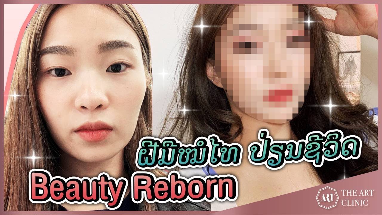 VLOG : OMG! สาวแดนลาวหน้าเปลี่ยน! เพราะทำจมูกและคางที่ The Art