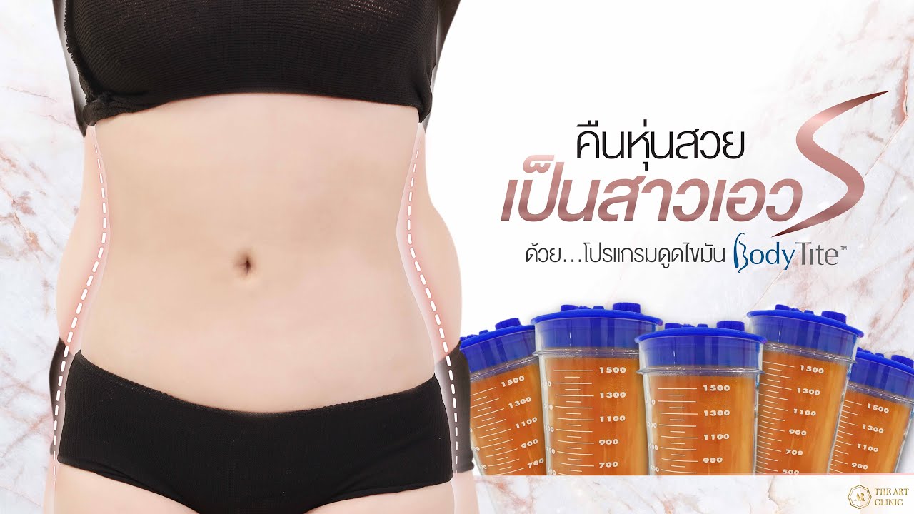 ดูดไขมัน : จากไซส์ XL เป็นไซส์S The Art