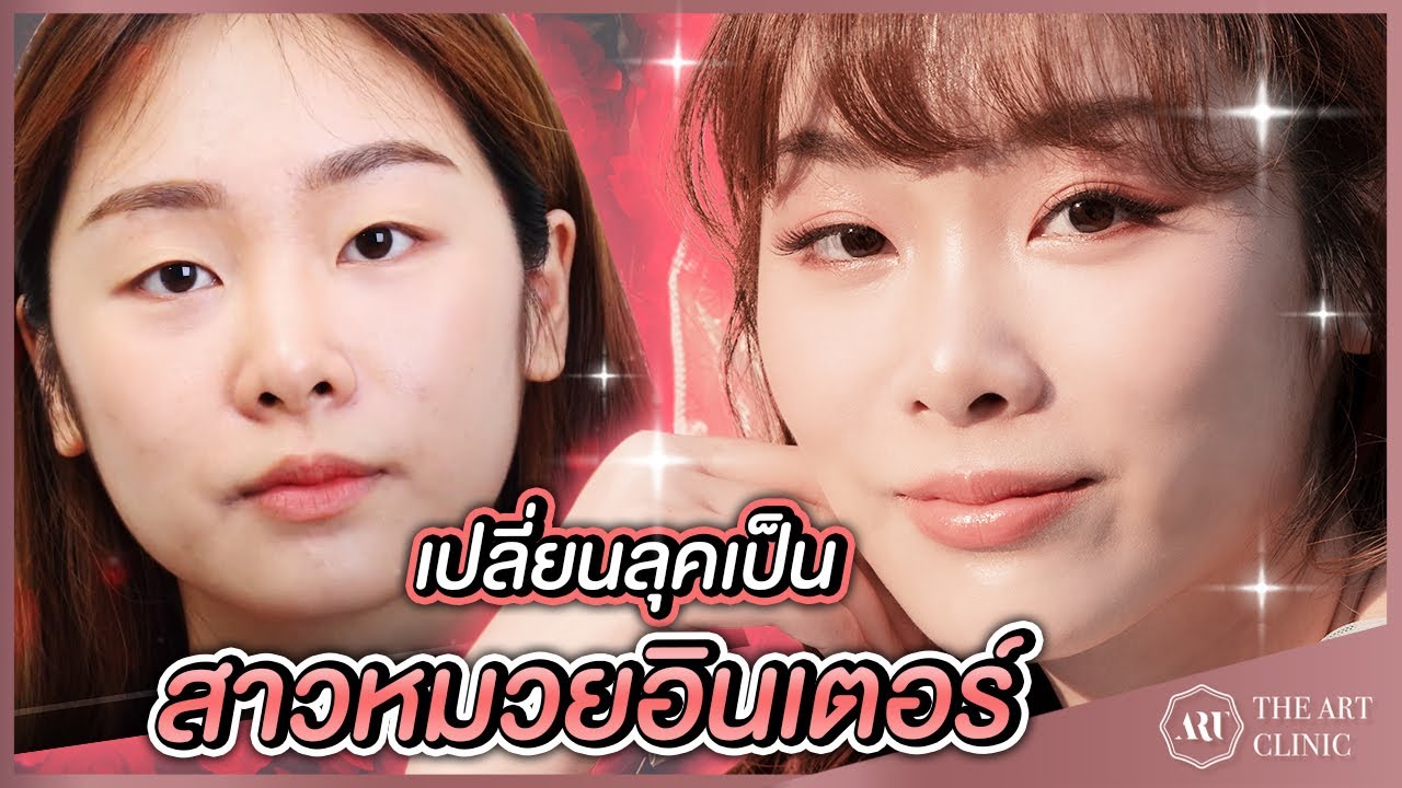 VLOG ตา 2 ชั้น : หมดปัญหาชั้นตาไม่เท่ากัน แก้ไขยังไงต้องดู The Art