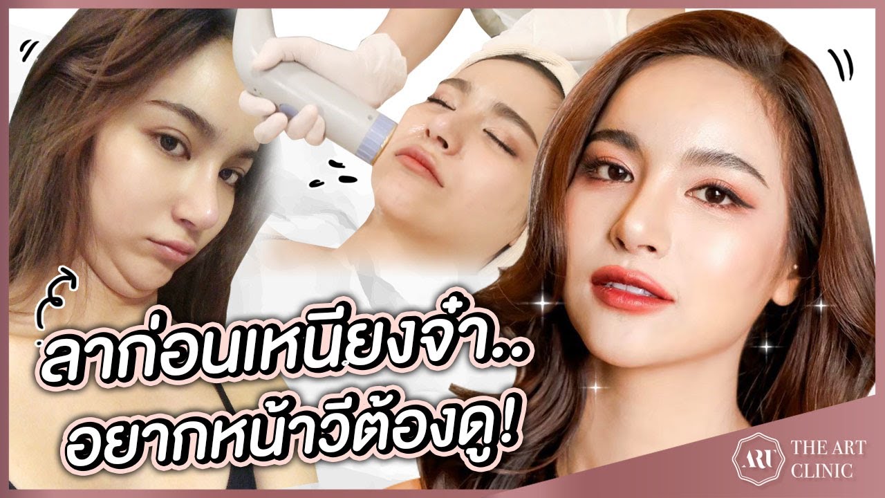 โปรแกรมระเบิดเหนียง : ผิวหน้ายกกระชับ หน้าเรียวx2 ด้วยเทคนิคเฉพาะของ The Art