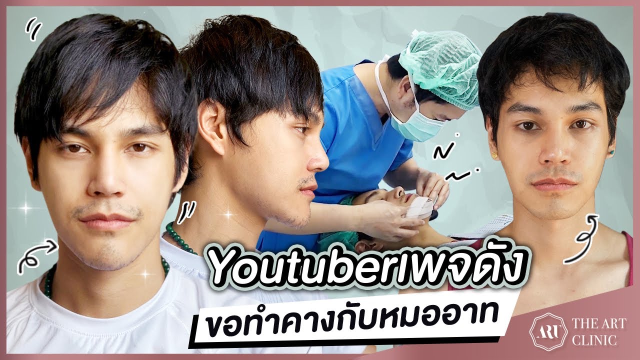 รีวิวเสริมคางผู้ชายที่ดีที่สุด : คางทรงนี้ หมออาทออกแบบเองที่ The Art