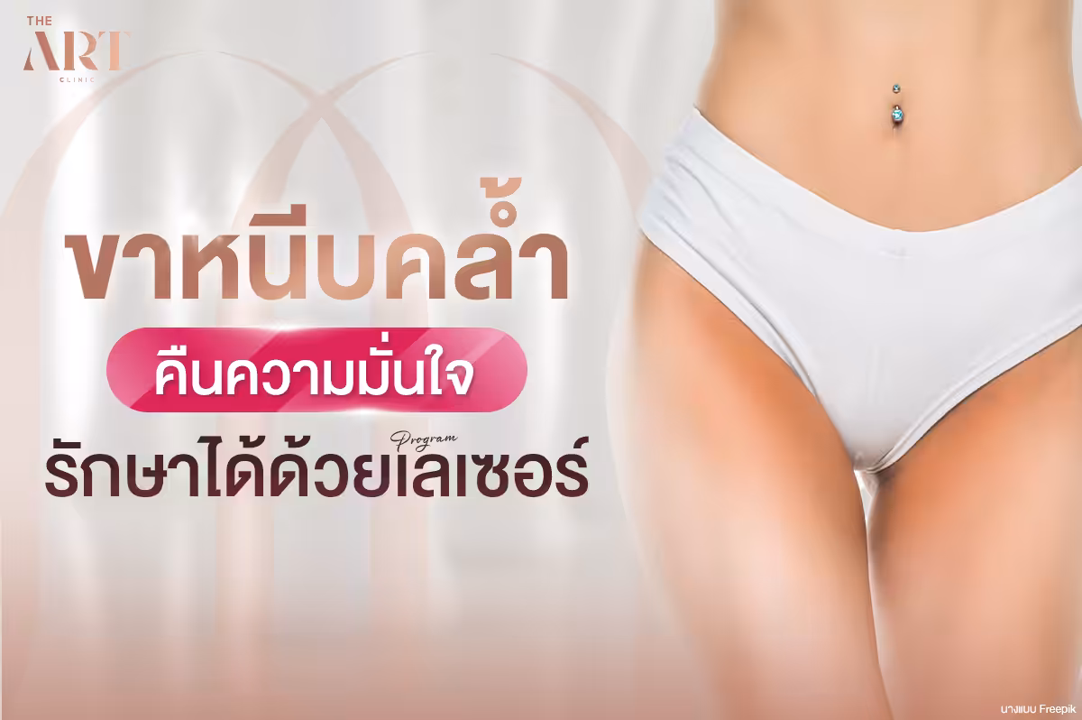 การดูแลและรักษาปัญหาที่ขาหนีบ--จากความคล้ำถึงการรักษาด้วยเลเซอร์-
