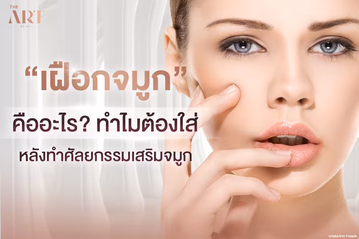 ทุกสิ่งที่คุณต้องรู้เกี่ยวกับการใช้เฝือกจมูกหลังการผ่าตัด