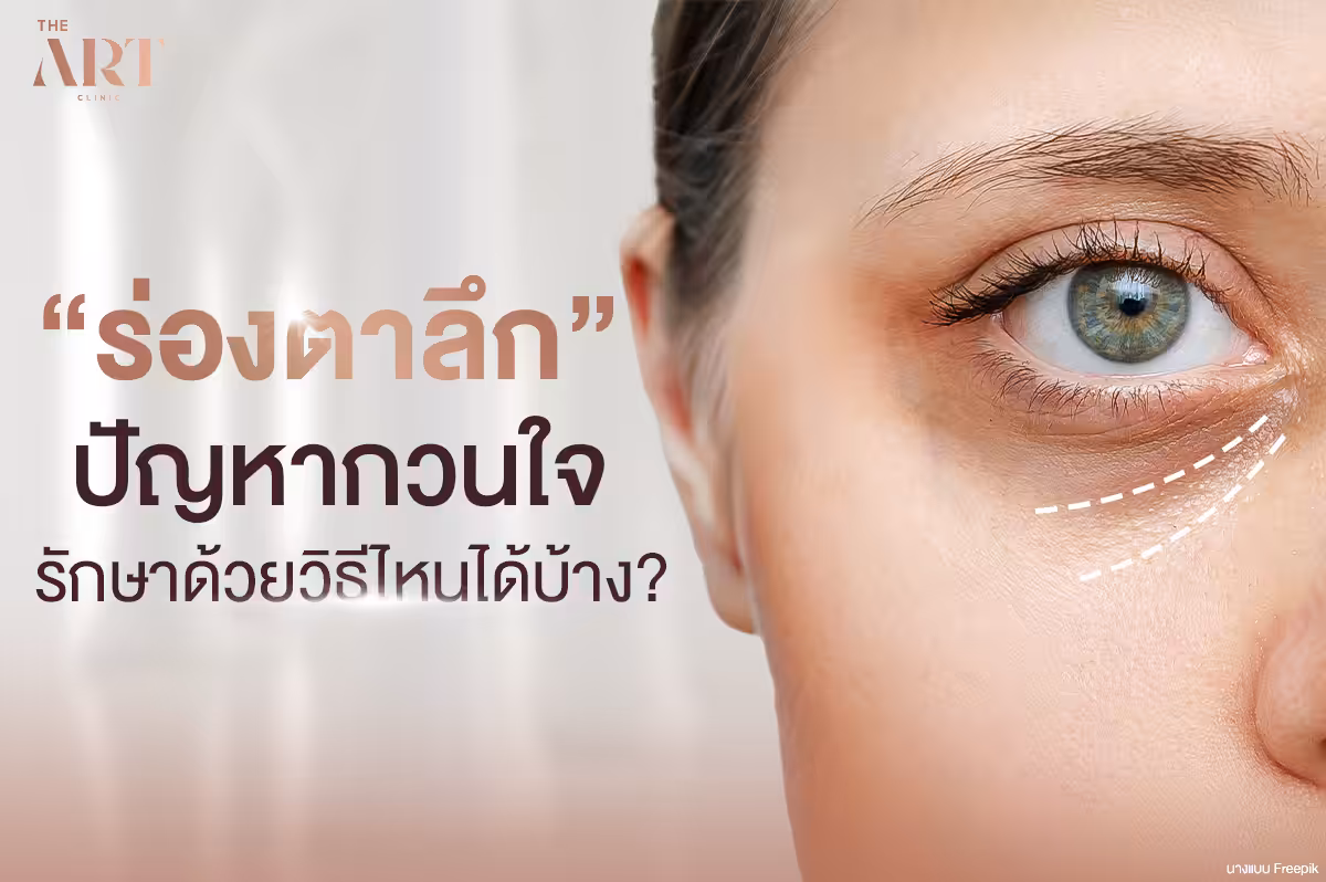 ร่องตาลึก--สาเหตุและวิธีการรักษาที่ครอบคลุม-
