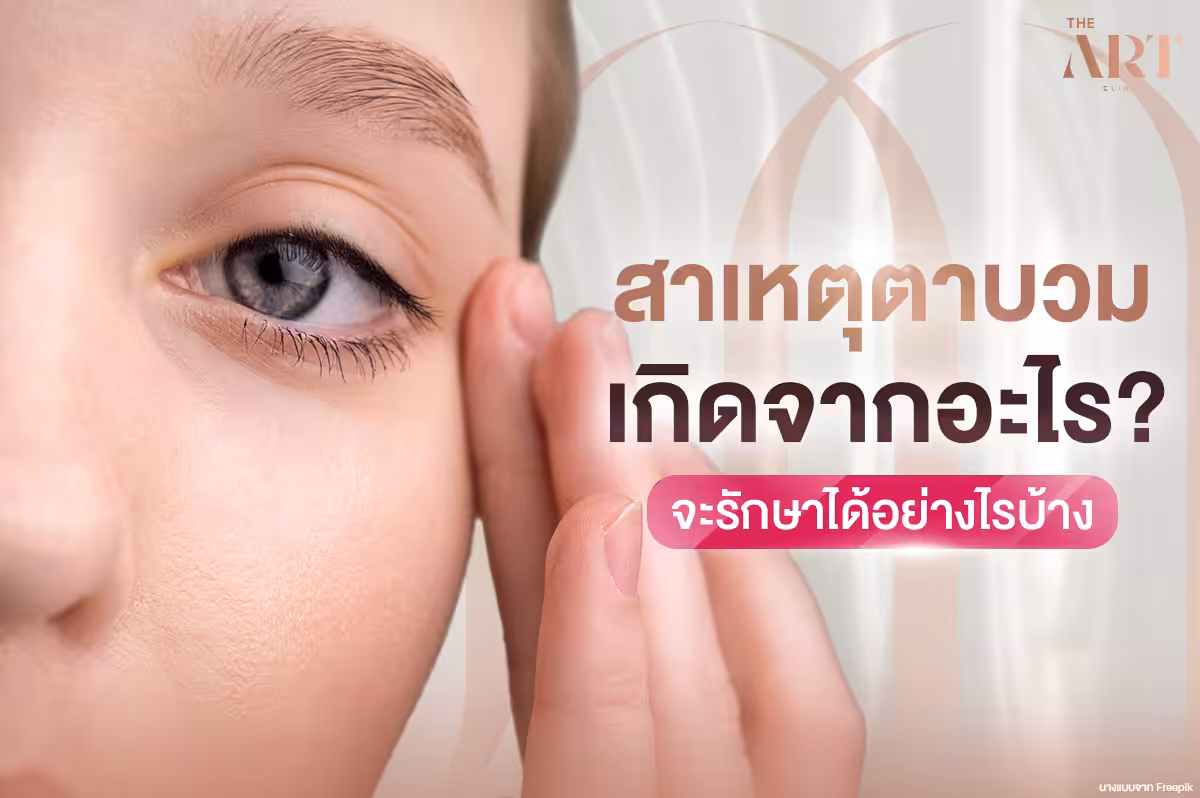 สาเหตุและการรักษาปัญหาตาบวม