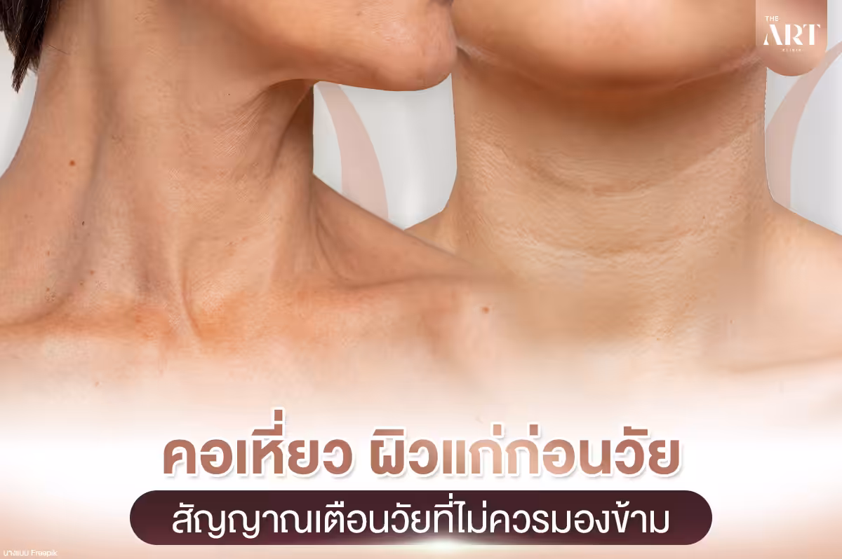 คอเหี่ยว--สัญญาณเตือนวัยที่ไม่ควรมองข้าม
