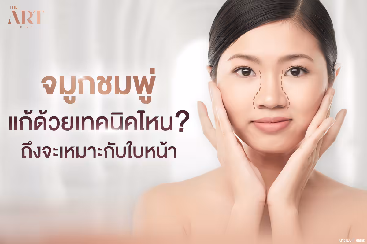 จมูกชมพู่ ความจริงที่คุณควรรู้