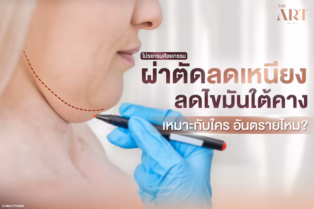 ตัดเหนียง--ทางเลือกสำหรับคนที่มีปัญหาเรื้อรัง