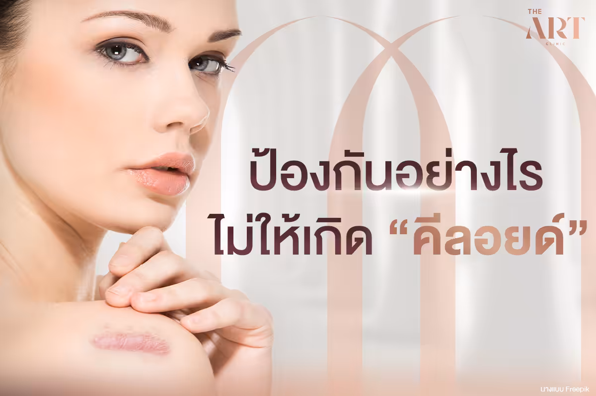 ปัญหาคีลอยด์--วิธีดูแลตัวเองเพื่อป้องกัน