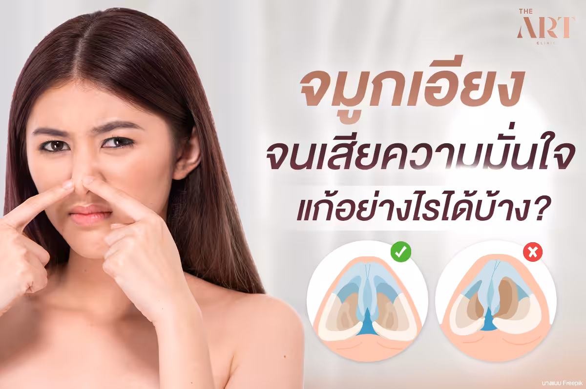 ปัญหาจมูกเอียงส่งผลกระทบต่อความมั่นใจและสุขภาพ-