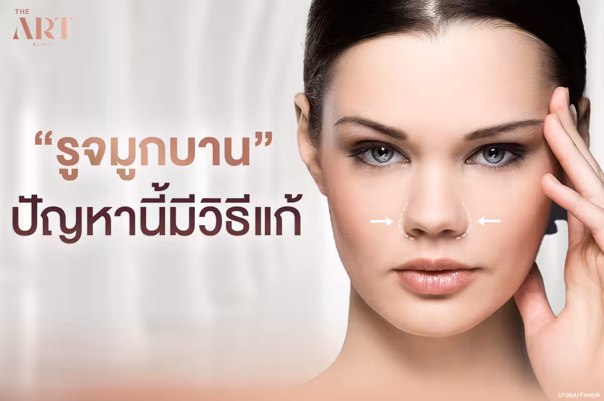 รูจมูกบาน มั่นใจได้ แค่เลือกวิธีที่ใช่