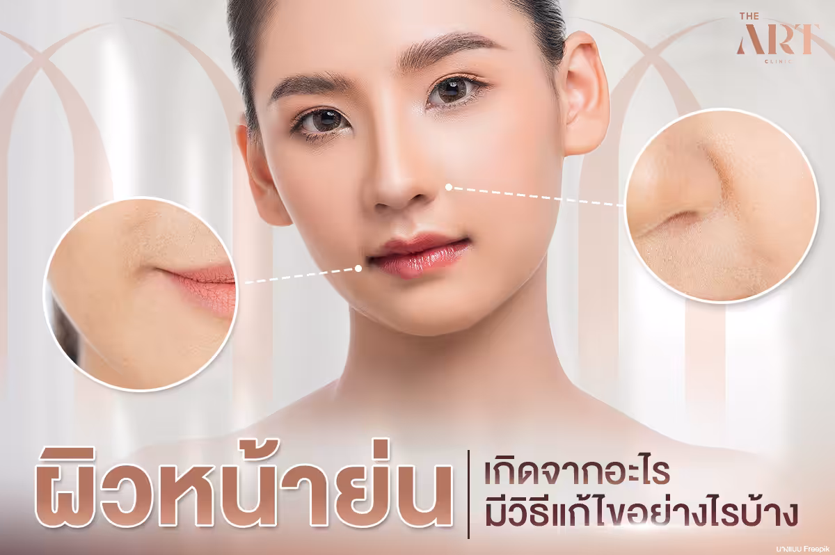 วิธีแก้ไขปัญหาหน้าย่น--สาเหตุและเทคนิคการรักษา
