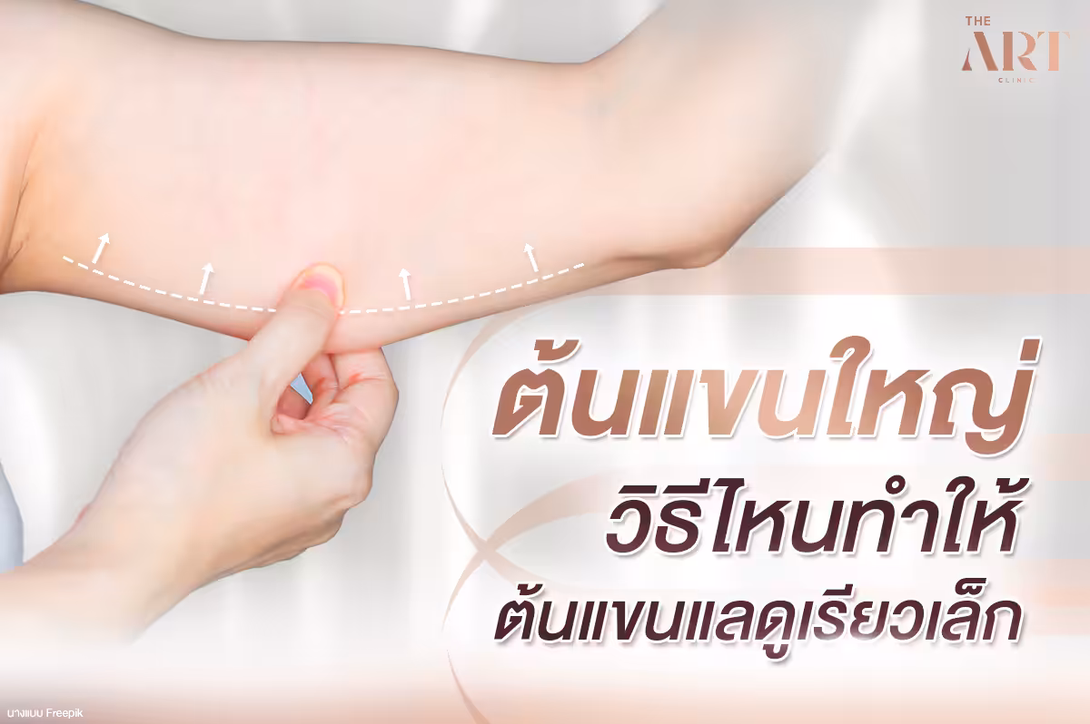 แขนใหญ่ใจไม่ใหญ่--เผชิญหน้ากับความกังวลเกี่ยวกับรูปร่าง