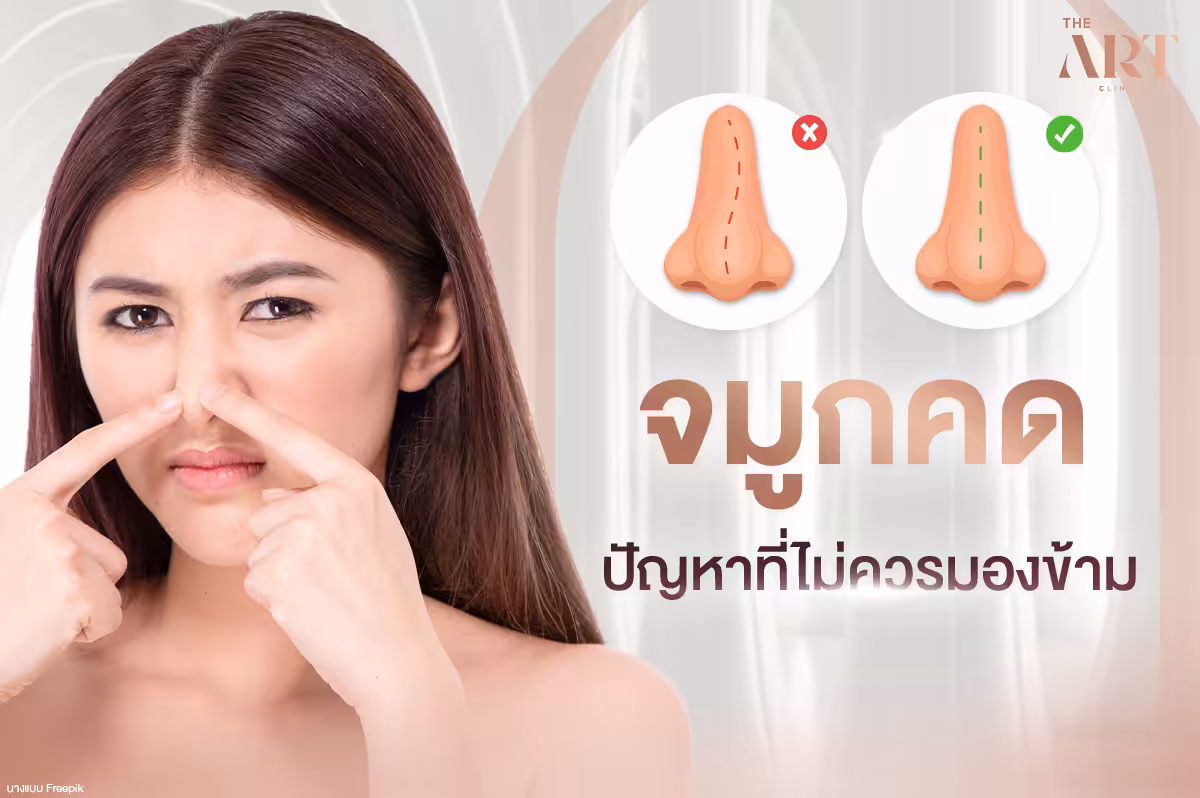 จมูกคด: สาเหตุ อาการ และวิธีการรักษา