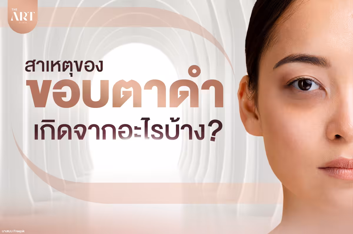 ปัญหาขอบตาดำสาเหตุอาการและวิธีแก้ไข