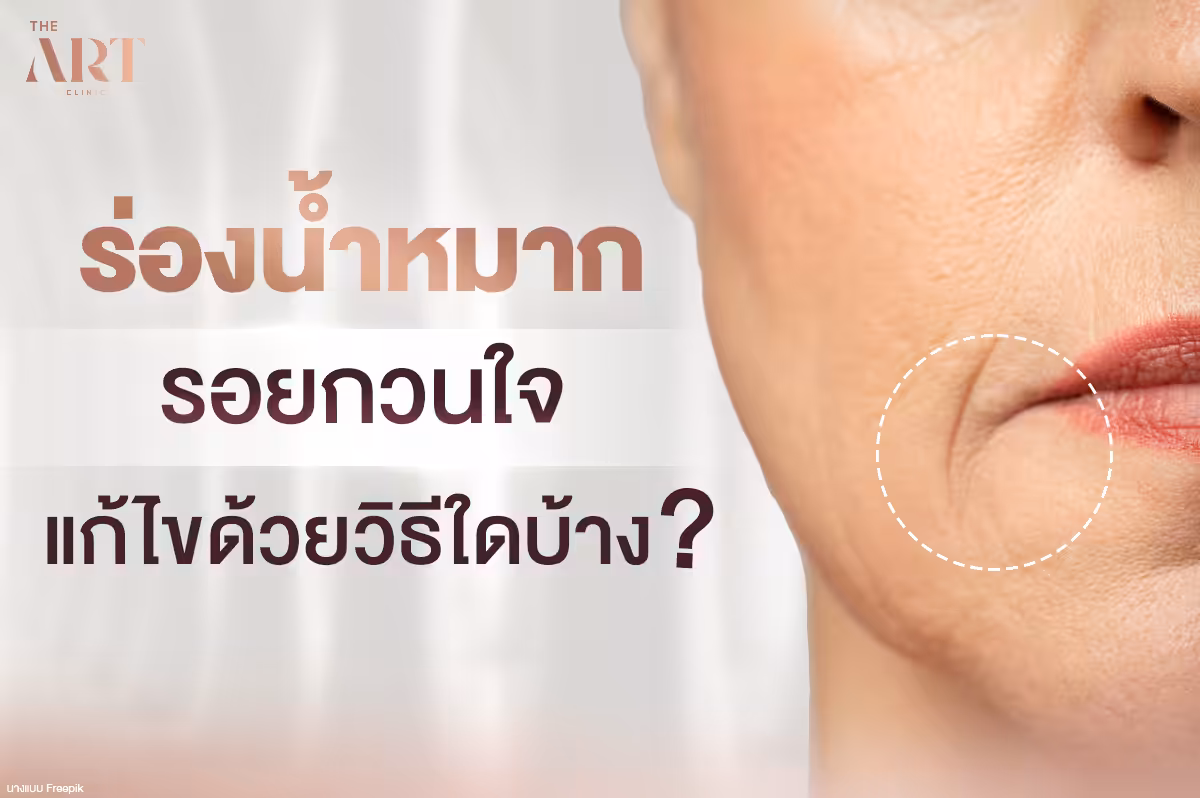 ร่องน้ำหมากรอยกวนใจที่บ่งบอกถึงอายุแก้ไขได้ด้วยวิธีใดบ้าง