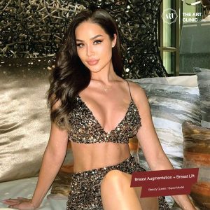 ฟรานเชสก้า | Motiva