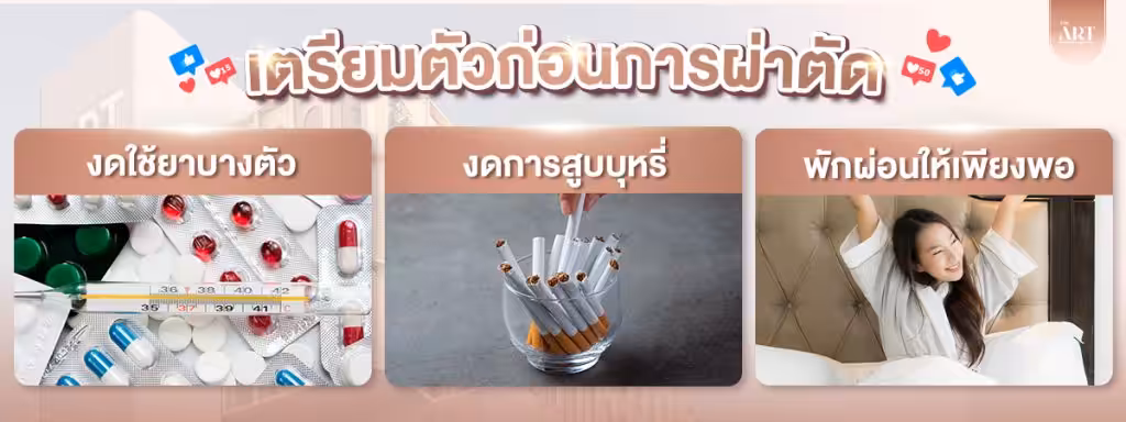 การเตรียมตัวก่อนการผ่าตัด