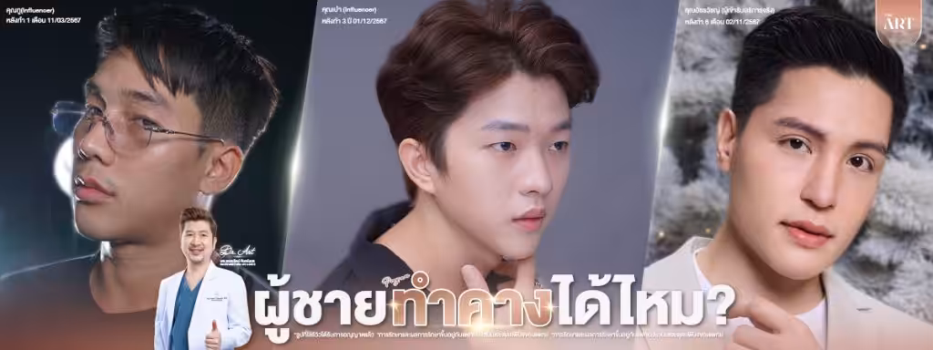 การทำคางผู้ชายสามารถทำได้ไหม