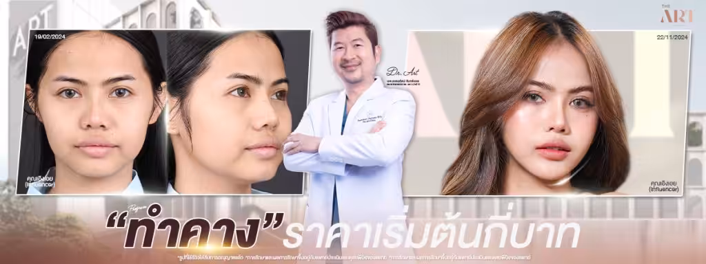 ทำศัลยกรรมคางราคาเท่าไหร่มีค่าใช้จ่ายอะไรเพิ่มเติมไหม