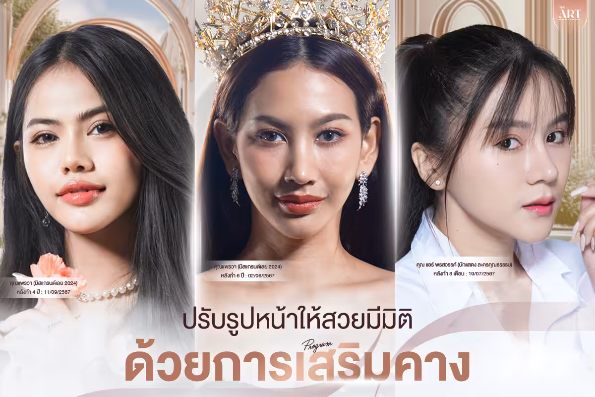 ปรับรูปหน้าให้สวยครบมิติ-ด้วยการเสริมคาง