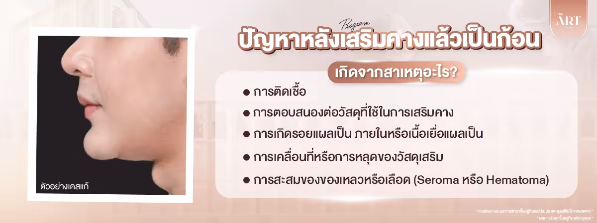 ปัญหาหลังเสริมคางแล้วเป็นก้อนเกิดจากสาเหตุอะไร