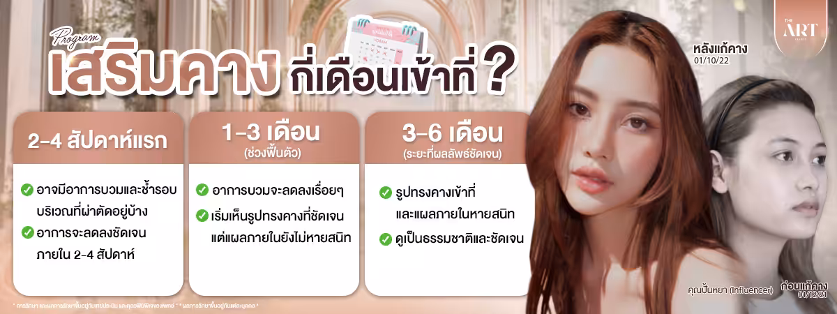หลังเสริมคางกี่เดือนเข้าที่2