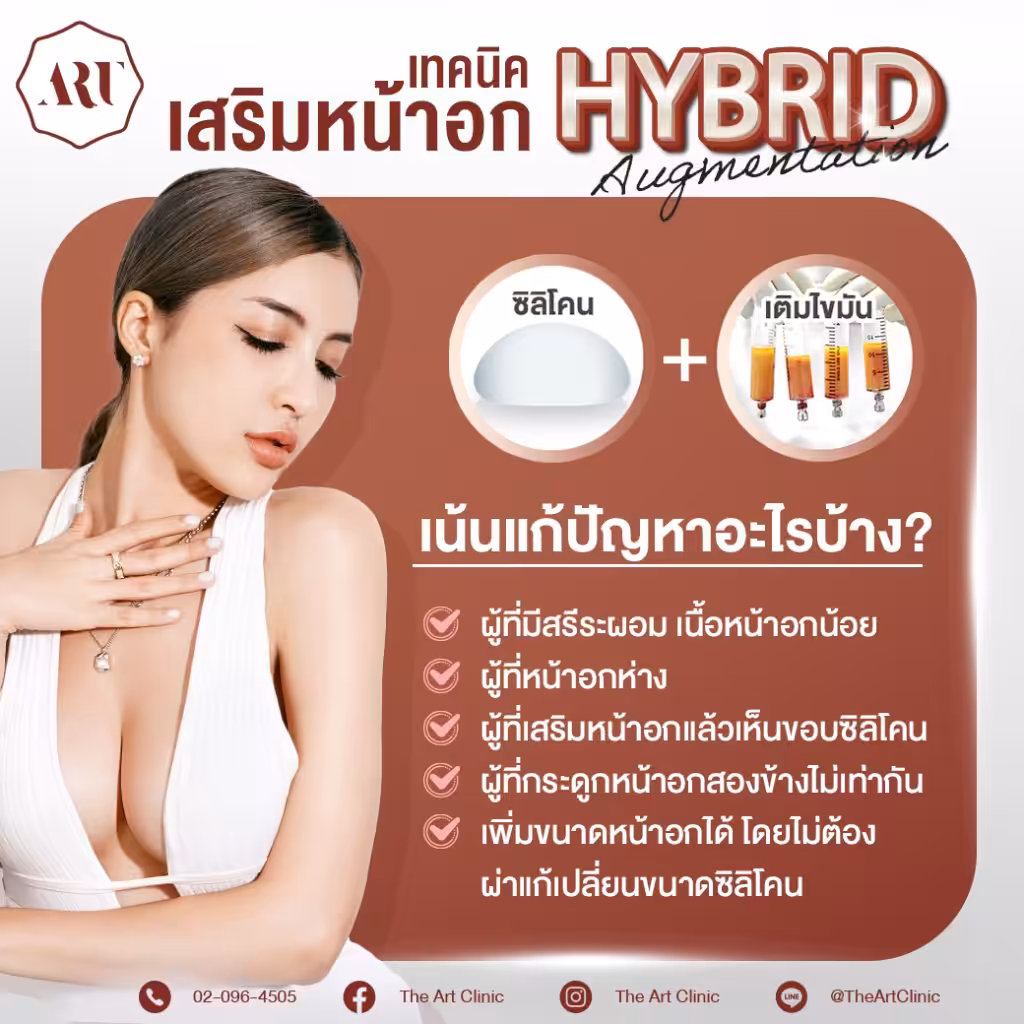 เสริมหน้าอก Hybrid