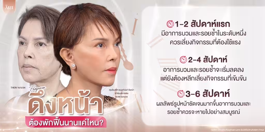 ศัลยกรรมดึงหน้าพักฟื้นนานไหม