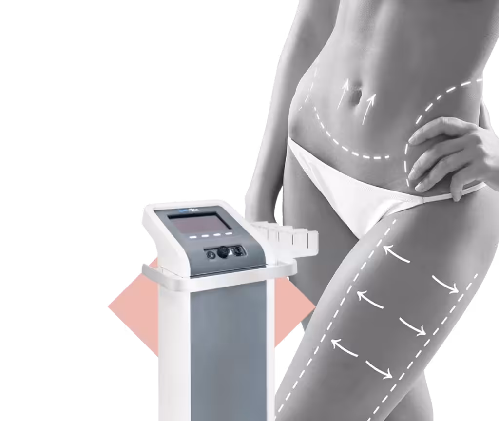 เครื่อง Body Tite ดูดไขมัน