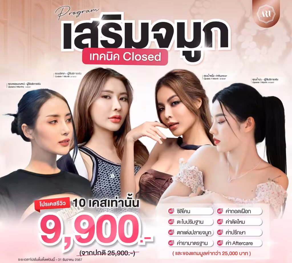 เสริมจมูกเทคนิค Closed