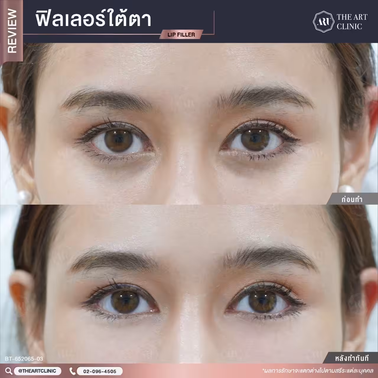 ใต้ตาแพนด้า