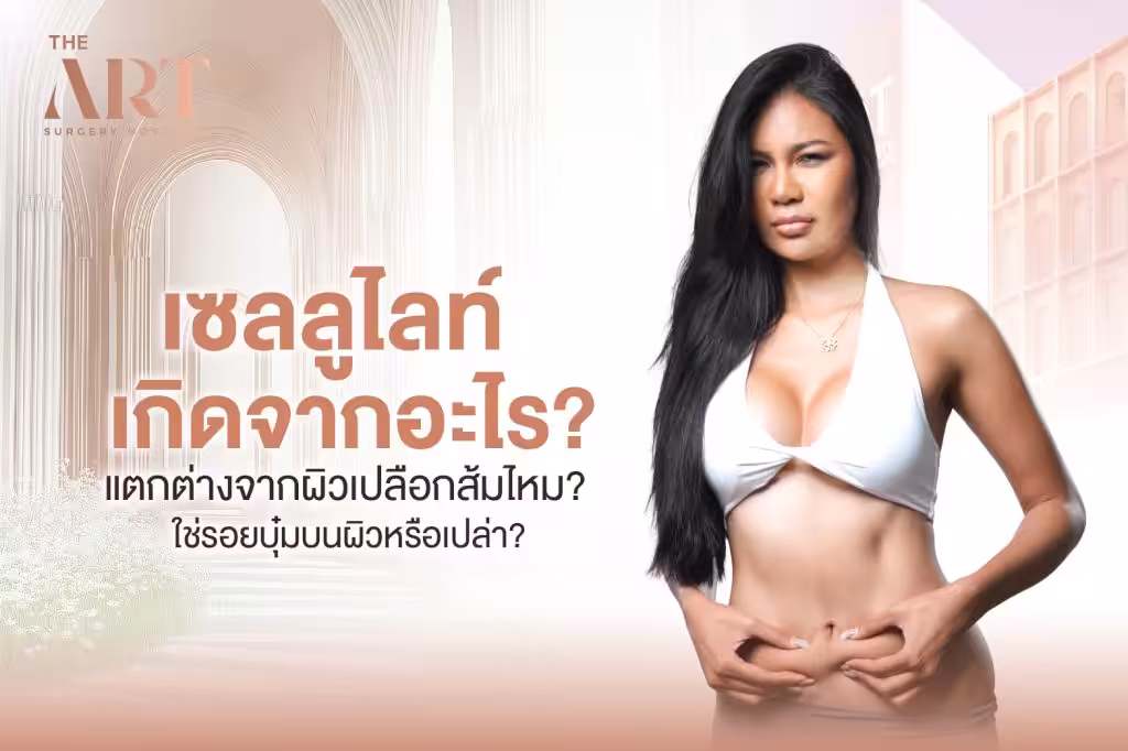 เซลลูไลท์
