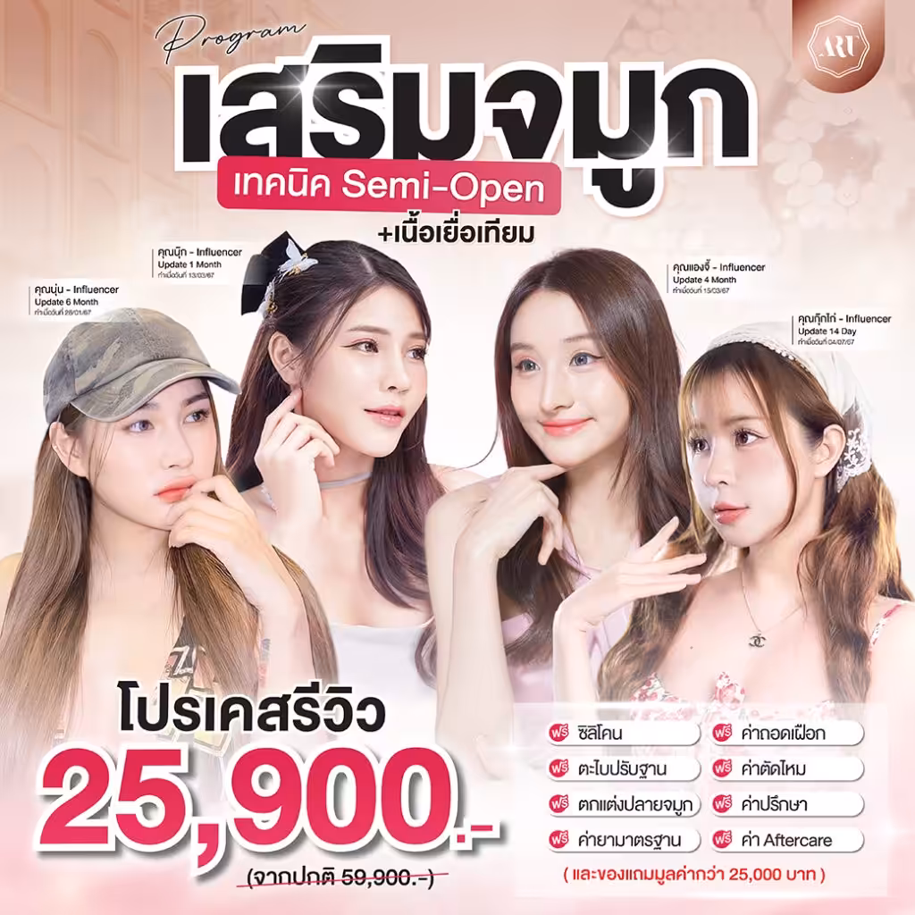 เสริมจมูกเทคนิค Semi-Open