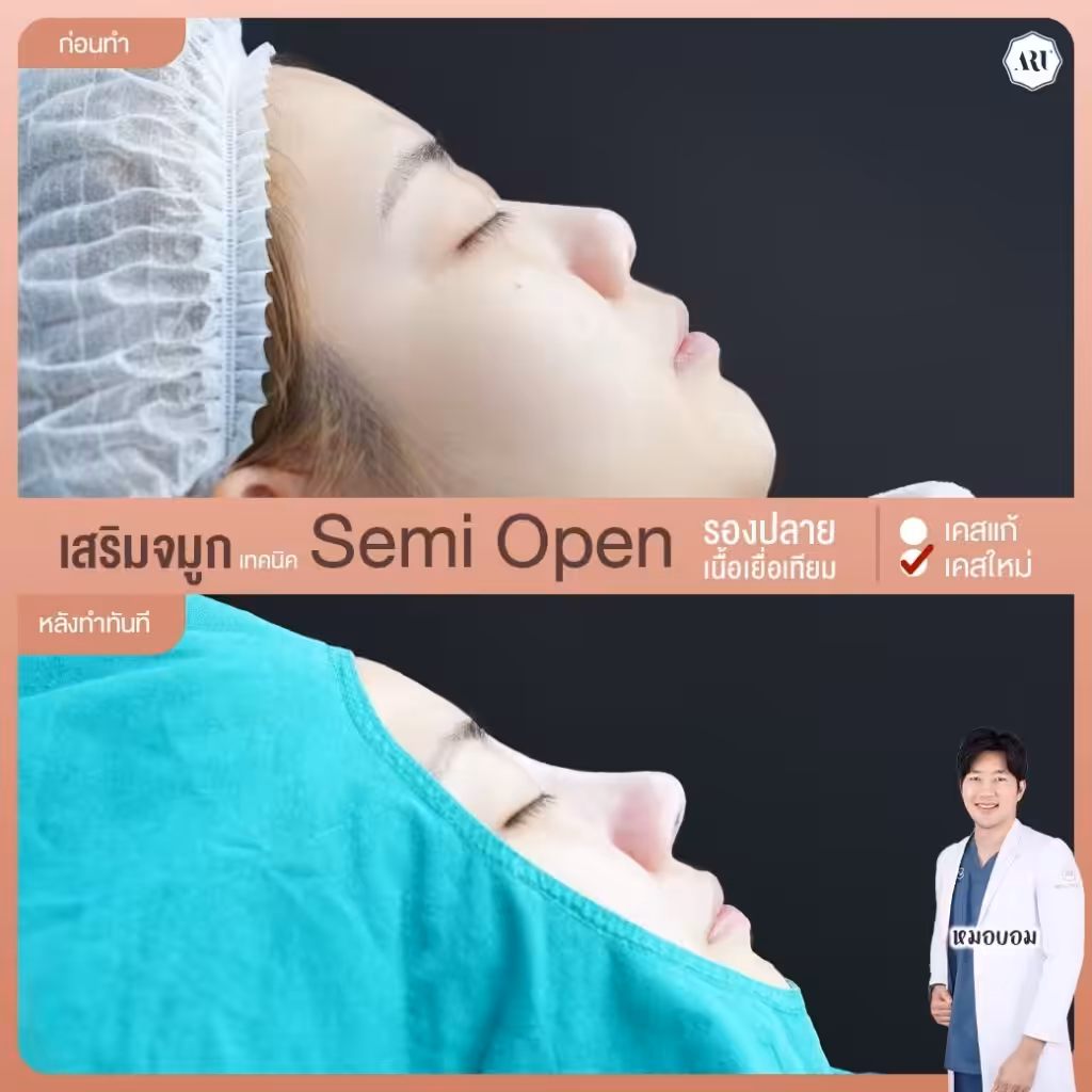 ทำจมูกหมอไหนดี