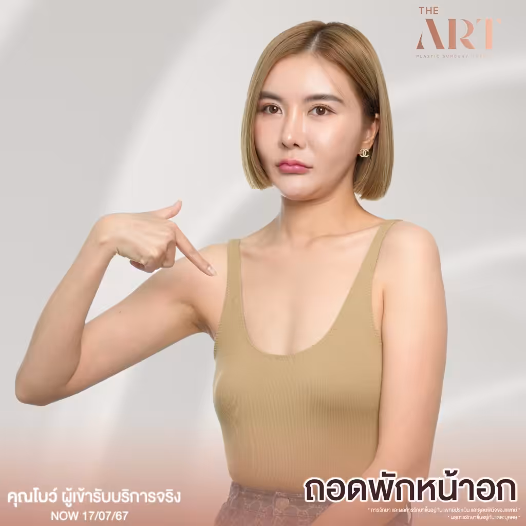 คุณโบว์ ผู้เข้ารับบริการจริง แสดงเหตุผลในการถอดพักหน้าอกที่ The Art Clinic