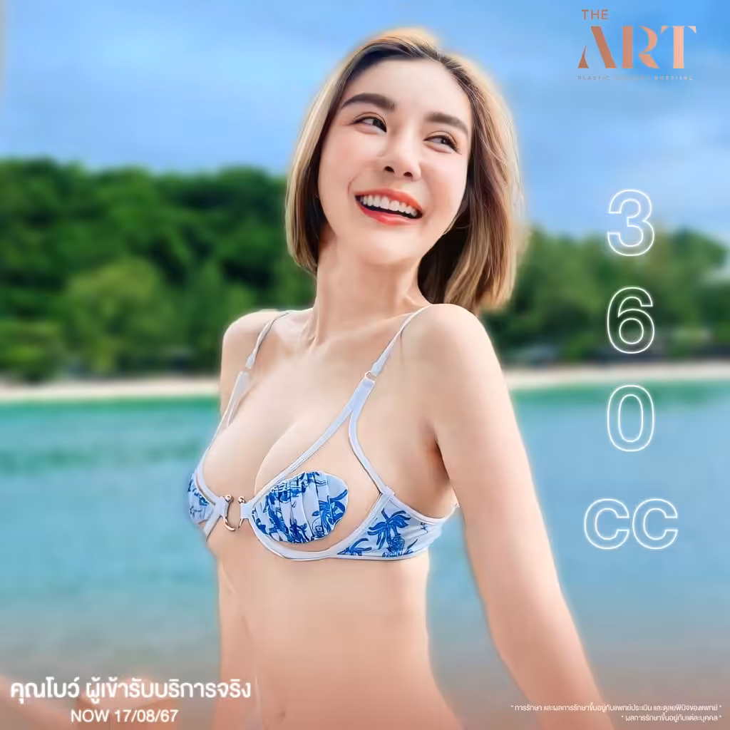 คุณโบว์ ผู้เข้ารับบริการจริงหลังเสริมหน้าอกขนาด 360cc กับ The Art Clinic ถ่ายที่ชายทะเล