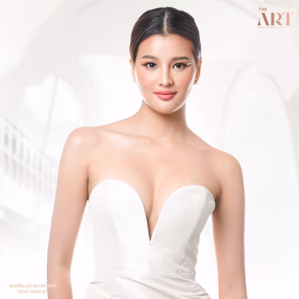 คุณเฟิร์น วรางณนา ในชุดราตรีสีขาว ลุคสง่างามมั่นใจหลังเสริมหน้าอกที่ The Art Clinic