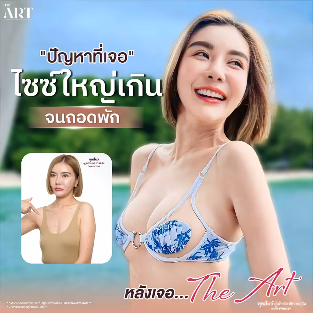ปัญหาหน้าอกใหญ่เกินไปจนต้องถอดพัก พร้อมภาพก่อนทำจากเคสจริง