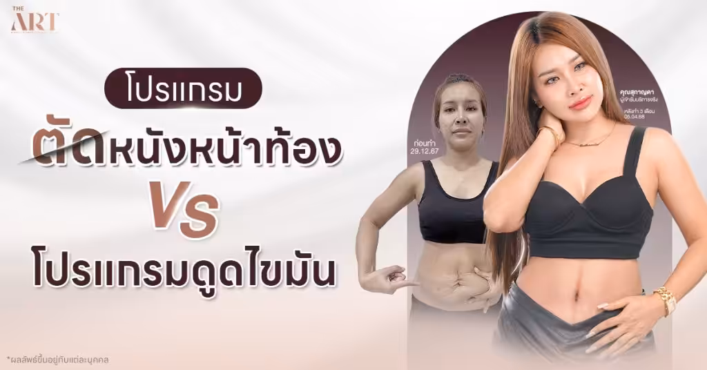 การตัดหนังหน้าท้องกับการดูดไขมัน เหมาะกับปัญหาแบบไหน ภาพรีวิวจากเคสจริงที่ The Art Clinic