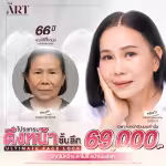 ultimate-face-lock-face-lift-promotion-69000-the-art.png