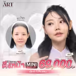 ultimate-face-lock-mini-face-lift-promotion-69000-the-art.png