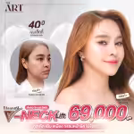 v-neck-lift-tightening-face-contour-promotion-69000-the-art.png