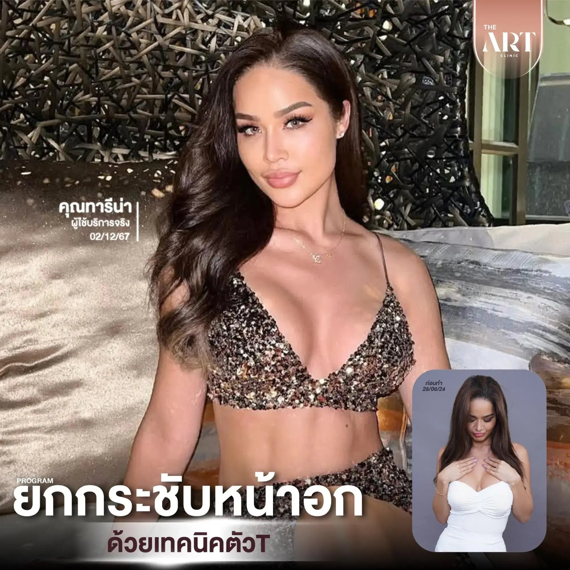 หน้าอกยานแก้ยังไง