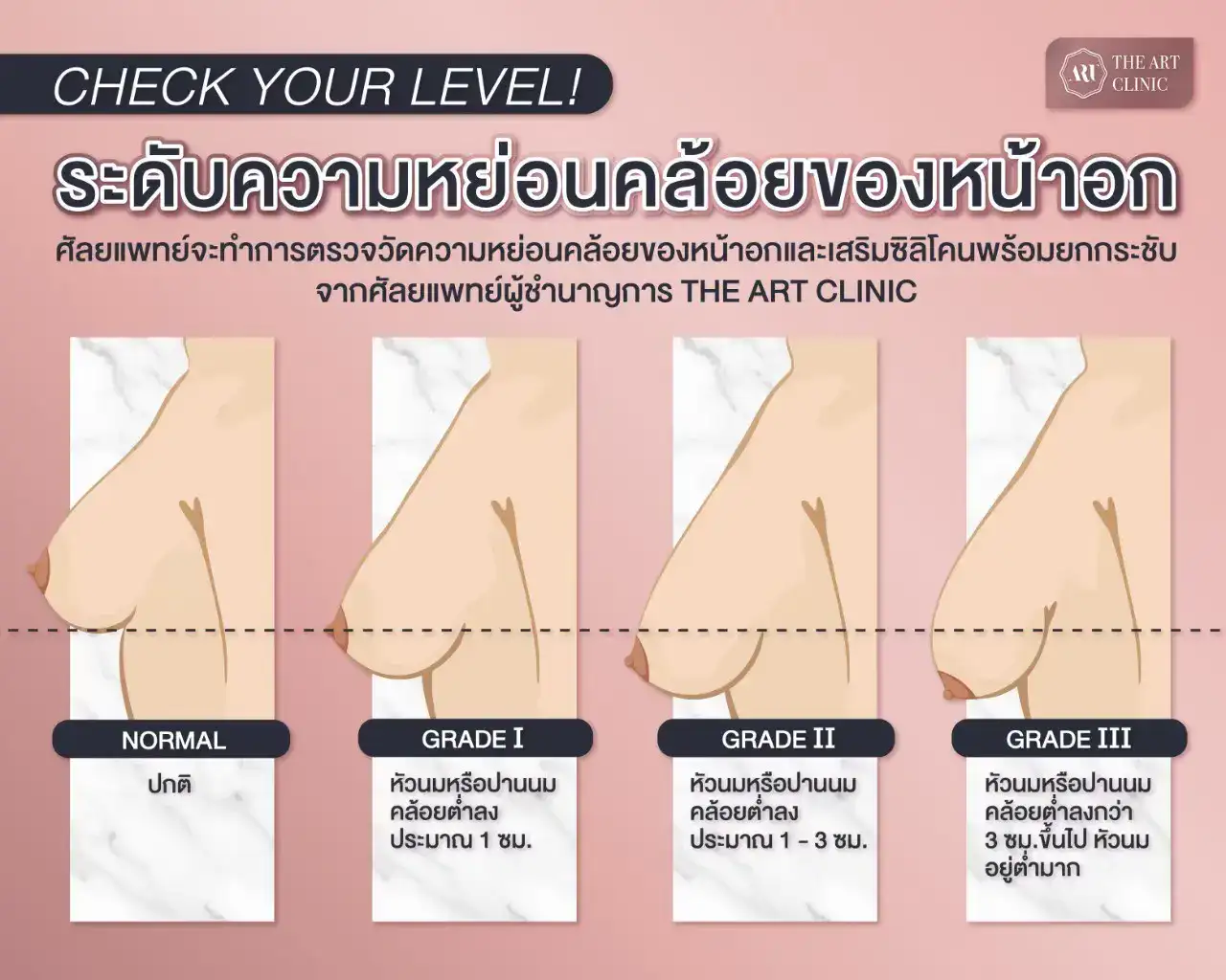 หน้าอกยาน