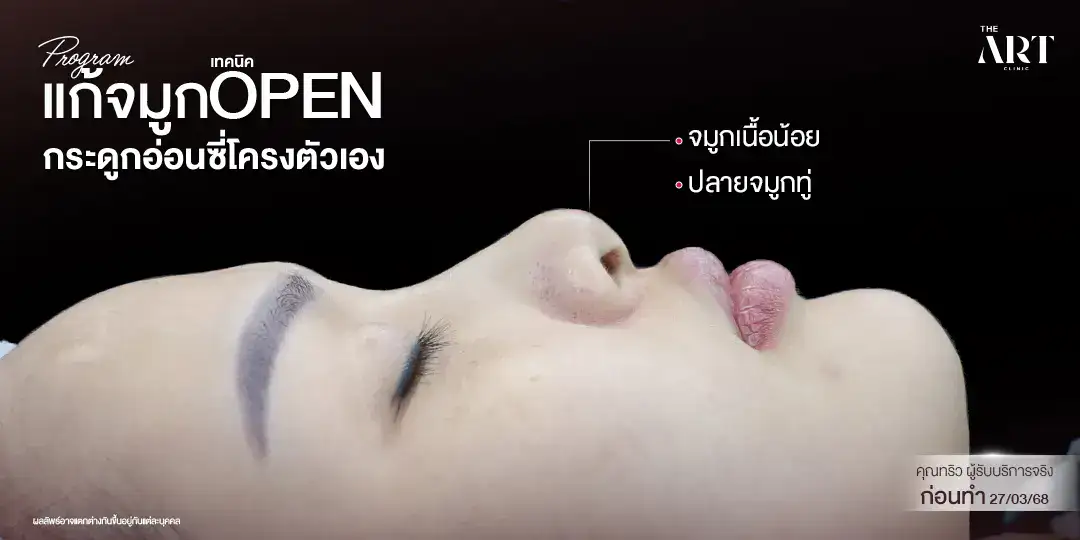 จมูกสั้น