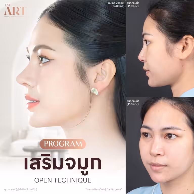จมูกOpen-เทมเพต-แฟชั่น_03.jpg