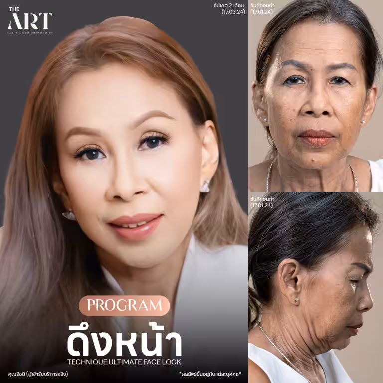 ดึงหน้า-คุณรัชนี.png