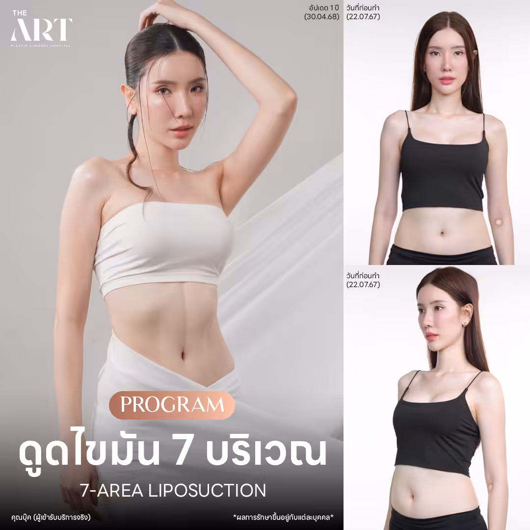 ดูดไขมัน-7-บริเวณ-แฟชั่นเช็ต-คุณ-บุ๊ค.png